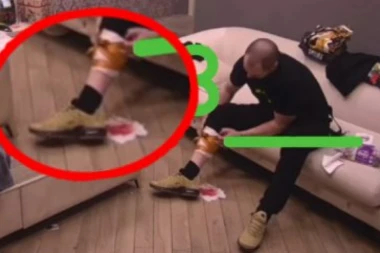 OVAKO SADA IZGLEDA ISKASAPLJENA NOGA ZVEZDANA SLAVNIĆA: U rijalitiju zbog Ane potegao nož na sebe, jedva zaustavili krvarenje! (FOTO)