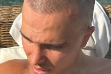 ŠTA MU JE SA LICEM?! Vojaž potpuno UNAKAŽEN NAKON RASKIDA , fanovi u ŠOKU zbog onoga što mu se desilo! (FOTO)